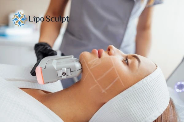 HIFU vs Botox Shipston on Stour What is the best option for you?