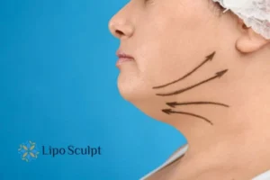 Boost your confidence with a Double chin treatment Shipston on Stour 