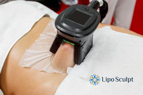 Does Fat Freezing at Home Work? DIY Devices vs Professional Cryolipolysis 1 How is professional cryolipolysis different Shipston on Stour?