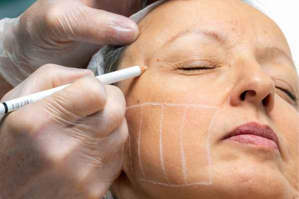 CryoPen: 5 Skin Concerns It May Be Used to Treat 4 What should you ask before having CryoPen treatment Shipston on Stour?