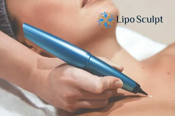What happens during CryoPen treatment?