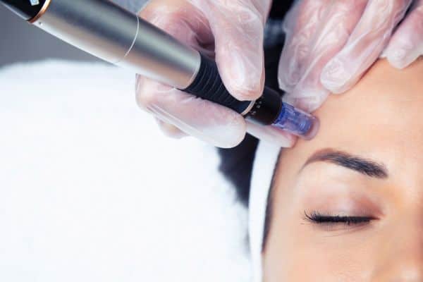 Why Does the Skin Need Time Between Treatments?