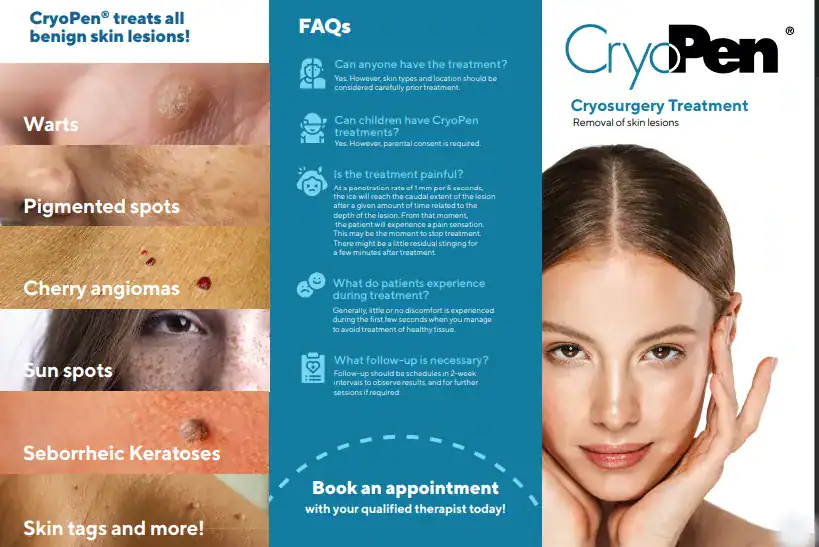 Benefits of Cryopen for seborrheic keratosis Removal Treatment Shipston on Stour