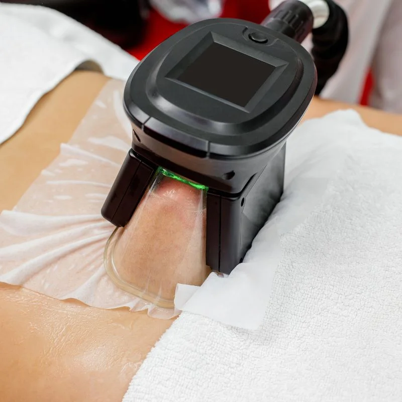 Fat Freezing treatment Shipston on Stour