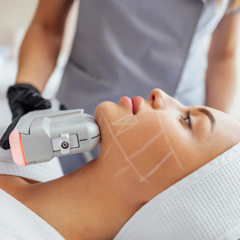 HIFU non surgical treatment Shipston on Stour